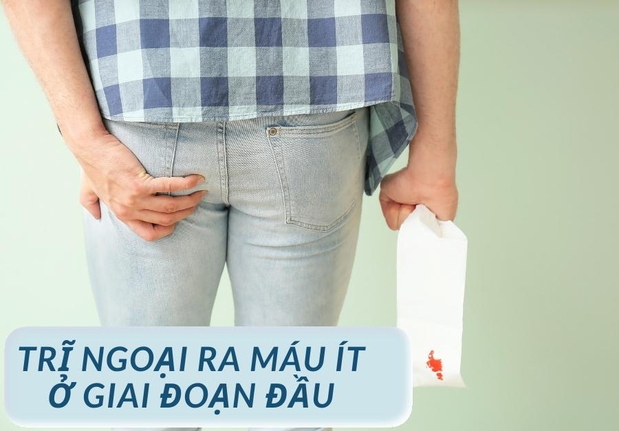 Bệnh trĩ ngoại ra máu tươi