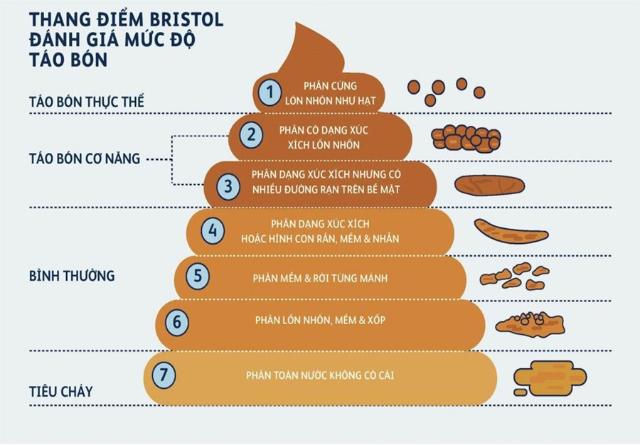 Bị táo bón có nguy hiểm không?