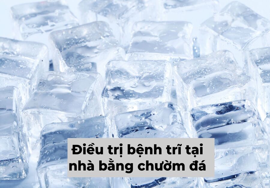 Những dấu hiệu bệnh trĩ sớm nhất để điều trị kịp thời